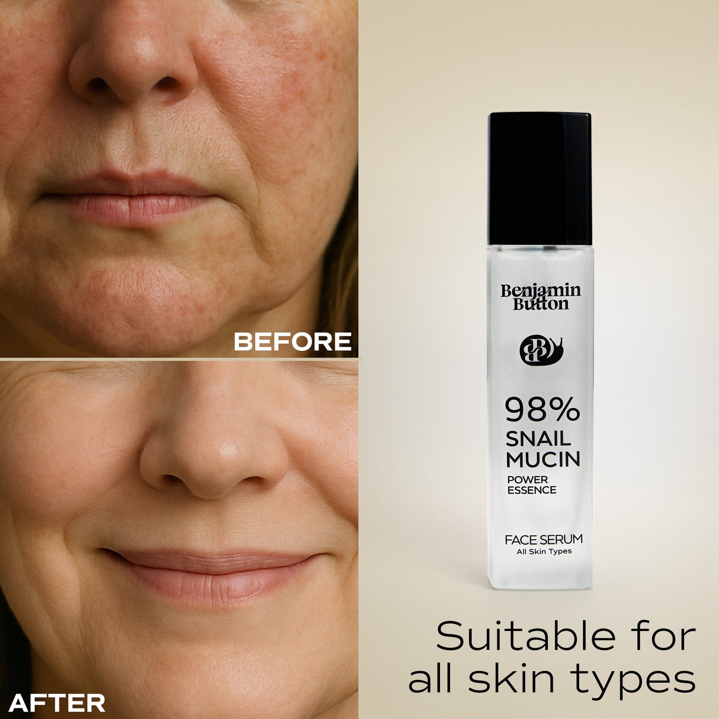 Before and after comparison of a woman's face with a bottle of Benjamin Button snail mucin serum.
