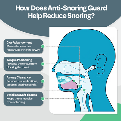 Anti Stop Snoring Mouth Guard