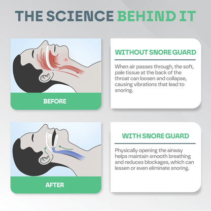 Anti Snore Mouth Guard Pro