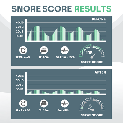 Anti Snore Mouth Guard Pro